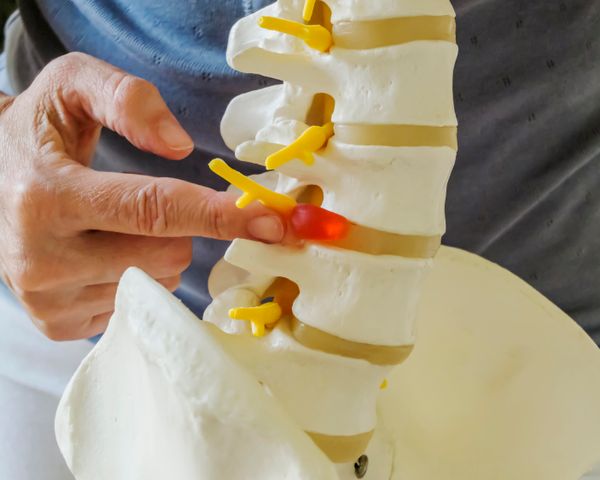 Model of a spine